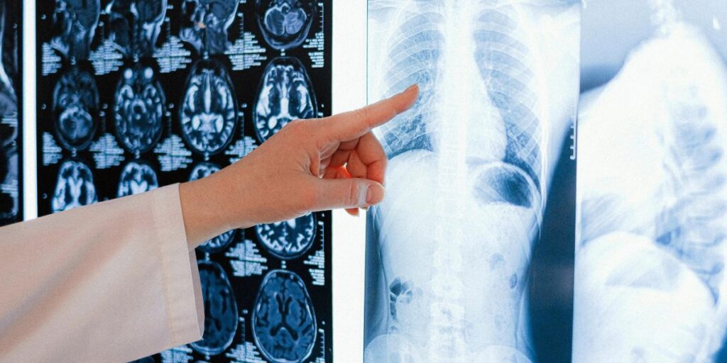 Skills and Qualities You Need to Succeed in Radiology Tech