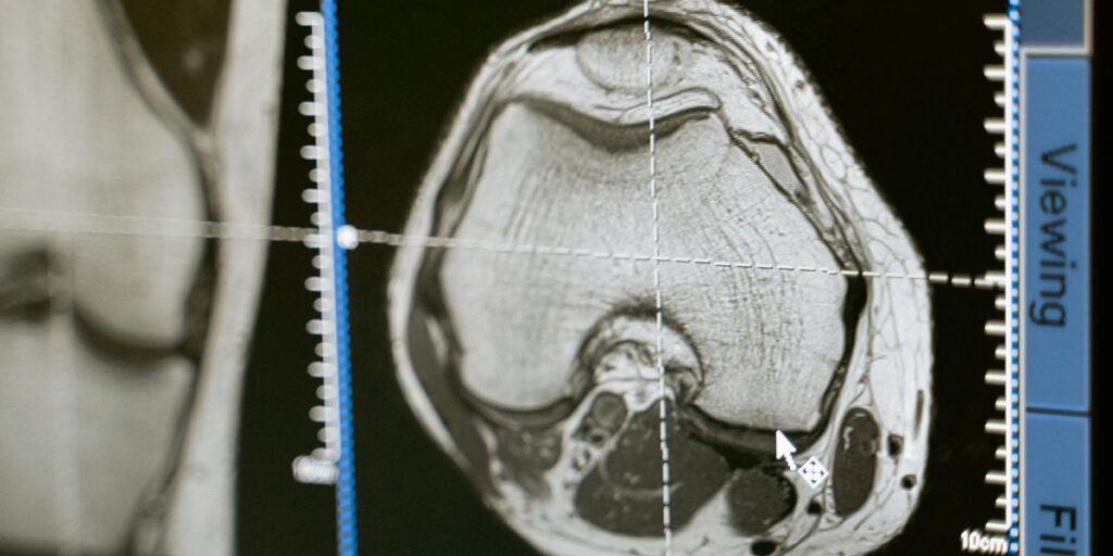 Step by Step Guide, Fastest Way to Become a Radiology Tech