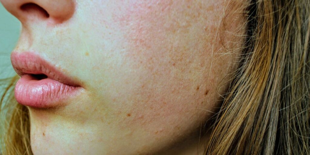 What Is Skin Texture?